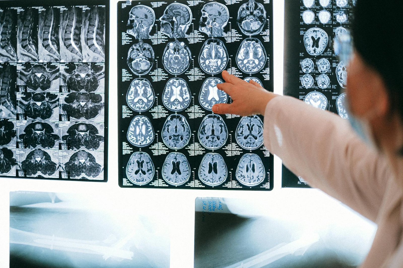 close up shot of mri results